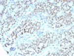 IHC staining of FFPE human fallopian tube tissue with BTBD9 antibody (clone BTBD9/7501). HIER: boil tissue sections in pH 9 10mM Tris with 1mM EDTA for 20 min and allow to cool before testing.