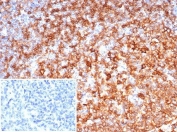 IHC staining of FFPE human tonsil tissue with HLA-DR antibody (clone rHLA-DRB/7198). Inset: PBS used in place of primary Ab (secondary Ab negative control). HIER: boil tissue sections in pH 9 10mM Tris with 1mM EDTA for 20 min and allow to cool before testing.