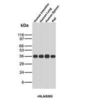 HLA-DR Antibody Recombinant Mouse MAb rHLA-DRA/8285 western blot analysis of human tissues and cells. Western blot testing was performed using recombinant mouse monoclonal HLA-DR antibody clone rHLA-DRA/8285. Lane 1: human intestine lysate, Lane 2: human lung lysate, Lane 3: human spleen lysate, Lane 4: human Raji cell lysate. A band is detected at approximately 34-36 kDa, consistent with the predicted molecular weight of Human leukocyte antigen DR alpha / HLA-DRA, the alpha chain of the HLA-DR major histocompatibility complex class II receptor expressed in antigen-presenting immune cells.