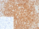 IHC staining of FFPE human tonsil tissue with HLA-DR antibody (clone rHLA-DRA/8285). Inset: PBS used in place of primary Ab (secondary Ab negative control). HIER: boil tissue sections in pH 9 10mM Tris with 1mM EDTA for 20 min and allow to cool before testing.