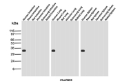 HLA-DR Antibody Recombinant Mouse MAb rHLA-DRA/8285 western blot analysis of multi-species tissues. Western blot testing was performed using recombinant mouse monoclonal HLA-DR antibody clone rHLA-DRA/8285. Lanes include intestine, lung, and spleen lysates from human, mouse, rat, hamster, guinea pig, and rabbit. A band is detected at approximately 33-35 kDa in human intestine, human lung, and human spleen samples, consistent with the predicted molecular weight of Human leukocyte antigen DR alpha / HLA-DRA, the alpha chain of the HLA-DR major histocompatibility complex class II receptor expressed in antigen-presenting immune cells. Bands are not observed in the corresponding tissues from other species under these conditions.