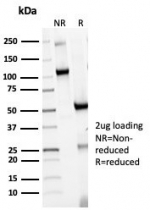 SDS-PAGE analysis of purified, BSA-free HLA-DR (HLA-DRA/6839R) as confirmation of integrity and purity.
