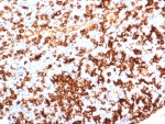 IHC staining of FFPE human tonsil tissue with HLA-DR antibody (clone HLA-DRA/6839R). HIER: boil tissue sections in pH 9 10mM Tris with 1mM EDTA for 20 min and allow to cool before testing.