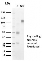 SDS-PAGE analysis of purified, BSA-free HLA-DR antibody (clone HLA-DRB/7058R) as confirmation of integrity and purity.