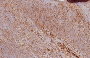 IHC staining of FFPE human tonsil tissue with HLA 1 ABC antibody (clone MHC-I/8147R). HIER: boil tissue sections in pH 9 10mM Tris with 1mM EDTA for 20 min and allow to cool before testing.