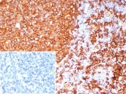 IHC staining of FFPE human tonsil tissue with HLA-DR antibody (clone HLA-DRB/7795R). Inset: PBS used in place of primary Ab (secondary Ab negative control). HIER: boil tissue sections in pH 9 10mM Tris with 1mM EDTA for 20 min and allow to cool before testing.