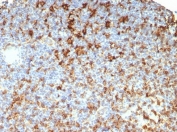 IHC staining of FFPE human lymph node tissue with HLA-DR antibody (clone HLA-DRB/7795R). HIER: boil tissue sections in pH 9 10mM Tris with 1mM EDTA for 20 min and allow to cool before testing.