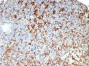 IHC staining of FFPE human lymph node tissue with HLA-DR antibody (clone HLA-DRB/7795R). HIER: boil tissue sections in pH 9 10mM Tris with 1mM EDTA for 20 min and allow to cool before testing.