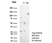 SDS-PAGE analysis of purified, BSA-free HLA-DR antibody (clone HLA-DRB/7795R) as confirmation of integrity and purity.
