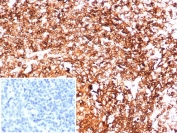 IHC staining of FFPE human tonsil tissue with HLA-DR antibody (clone HLA-DRA/6844R). Inset: PBS used in place of primary Ab (secondary Ab negative control). HIER: boil tissue sections in pH 9 10mM Tris with 1mM EDTA for 20 min and allow to cool before testing.