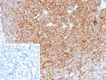 IHC staining of FFPE human tonsil tissue with HLA-DP/DQ/DR antibody (clone HLA-Pan/8622R). Inset: PBS used in place of primary Ab (secondary Ab negative control). HIER: boil tissue sections in pH 9 10mM Tris with 1mM EDTA for 20 min and allow to cool before testing.