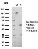 SDS-PAGE analysis of purified, BSA-free HCG-alpha antibody (clone hCGa/7873) as confirmation of integrity and purity.
