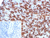 Allograft inflammatory factor 1 Antibody Spleen IHC. Immunohistochemistry of Allograft inflammatory factor 1 Antibody clone AIF1/8970R in human spleen tissue. Formalin-fixed, paraffin-embedded spleen demonstrates cytoplasmic HRP-DAB brown staining in numerous macrophage-lineage cells within the splenic red pulp and scattered immune cells in the white pulp, consistent with Allograft inflammatory factor 1 expression in activated macrophages and mononuclear phagocytes. Heat-induced epitope retrieval was performed by boiling tissue sections in pH 9 10mM Tris with 1mM EDTA for 20 minutes followed by cooling prior to staining. The monoclonal antibody clone AIF1/8970R was used as the primary antibody. Inset: PBS was used in place of the primary antibody as a secondary antibody negative control.