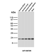 Allograft inflammatory factor 1 Antibody Human Tissue WB. Western blot analysis of human brain, liver, kidney, spleen, and RAW cell lysates using AIF1 Antibody (clone AIF1/8970R) detects a band at the predicted molecular weight of approximately 17 kDa, consistent with Allograft inflammatory factor 1 expression across diverse human tissues and macrophage-derived cells.