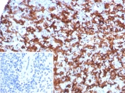 IHC staining of FFPE human spleen tissue with Allograft inflammatory factor 1 antibody (clone AIF1/8970R). Inset: PBS used in place of primary Ab (secondary Ab negative control). HIER: boil tissue sections in pH 9 10mM Tris with 1mM EDTA for 20 min and allow to cool before testing.