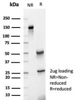 SDS-PAGE analysis of purified, BSA-free HLA-G antibody (clone HLAG/7094) as confirmation of integrity and purity.