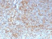 IHC staining of FFPE human tonsil tissue with HLA-G antibody (clone HLAG/7095). HIER: boil tissue sections in pH 9 10mM Tris with 1mM EDTA for 20 min and allow to cool before testing.