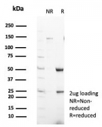SDS-PAGE analysis of purified, BSA-free SCGN antibody (clone SCGN/7326) as confirmation of integrity and purity.