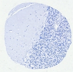 Negative control: IHC testing of FFPE human brain tissue with Interferon regulatory factor 4 antibody (clone MUM1/8560R) at 2ug/ml. HIER: boil tissue sections in pH 9 10mM Tris with 1mM EDTA for 20 min and allow to cool before testing.
