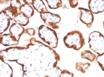 IHC staining of FFPE human placental tissue with HCG-beta antibody (clone hCGa/7138). HIER: boil tissue sections in pH 9 10mM Tris with 1mM EDTA for 20 min and allow to cool before testing.