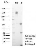 SDS-PAGE analysis of purified, BSA-free HCG-alphaantibody (clone hCGa/7872) as confirmation of integrity and purity.