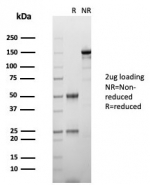 SDS-PAGE analysis of purified, BSA-free HCG-alpha antibody (clone hCGa/7875) as confirmation of integrity and purity.