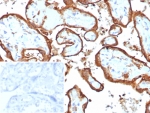 IHC staining of FFPE human placental tissue with HCG-alpha antibody (clone HCGa/7806R). Inset: PBS used in place of primary Ab (secondary Ab negative control). HIER: boil tissue sections in pH 9 10mM Tris with 1mM EDTA for 20 min and allow to cool before testing.