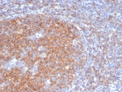 IHC staining of FFPE human tonsil tissue with CD73 antibody (clone NT5E/4679). HIER: boil tissue sections in pH 9 10mM Tris with 1mM EDTA for 20 min and allow to cool before testing.