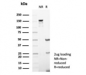 SDS-PAGE analysis of purified, BSA-free CD73 antibody (clone NT5E/4679) as confirmation of integrity and purity.
