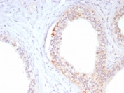 IHC staining of FFPE human epididymis tissue with ROS1 antibody (clone ROS1/8216R). HIER: boil tissue sections in pH 9 10mM Tris with 1mM EDTA for 20 min and allow to cool before testing.