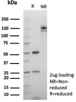 SDS-PAGE analysis of purified, BSA-free ROS1 antibody (clone ROS1/8268R) as confirmation of integrity and purity.