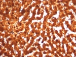 IHC staining of FFPE human liver tissue with ARG1 antibody (clone ARG1/7514R). HIER: boil tissue sections in pH 9 10mM Tris with 1mM EDTA for 20 min and allow to cool before testing.