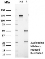 SDS-PAGE analysis of purified, BSA-free IL20R alpha antibody (clone IL20RA/1752) as confirmation of integrity and purity.
