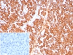 IHC staining of FFPE human pancreas tissue with Carboxypeptidase A1 antibody (clone CPA1/8784). Inset: PBS used in place of primary Ab (secondary Ab negative control). HIER: boil tissue sections in pH 9 10mM Tris with 1mM EDTA for 20 min and allow to cool before testing.