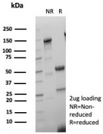 SDS-PAGE analysis of purified, BSA-free ER-A antibody (clone ESR1/8407R) as confirmation of integrity and purity.