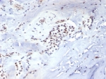 IHC staining of FFPE human parathyroid tissue with Brachyury antibody (clone TBXT/7711R). HIER: boil tissue sections in pH 9 10mM Tris with 1mM EDTA for 20 min and allow to cool before testing.