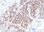 IHC staining of FFPE human parathyroid tissue with TBXT antibody (clone TBXT/7853R). HIER: boil tissue sections in pH 9 10mM Tris with 1mM EDTA for 20 min and allow to cool before testing.