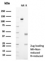 SDS-PAGE analysis of purified, BSA-free EGF Receptor antibody (clone EGFR/4616) as confirmation of integrity and purity.