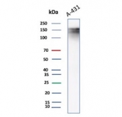Western blot testing of A431 lysate using Epidermal Growth Factor Receptor antibody. Expected molecular weight: 134-180 kDa depending on glycosylation level.