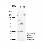 SDS-PAGE analysis of purified, BSA-free Interleukin 6 antibody (clone IL6/4643) as confirmation of integrity and purity.