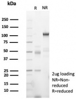 SDS-PAGE analysis of purified, BSA-free PMS2 antibody (clone PMS2/8374R) as confirmation of integrity and purity.