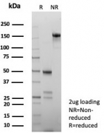 SDS-PAGE analysis of purified, BSA-free PMS2 antibody (clone PMS2/8224R) as confirmation of integrity and purity.