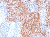 IHC staining of FFPE human spleen tissue with CD36 antibody (clone CD36/7218) at 2ug/ml. Inset: PBS used in place of primary Ab (secondary Ab negative control). HIER: boil tissue sections in pH 9 10mM Tris with 1mM EDTA for 20 min and allow to cool before testing.