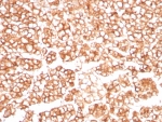 IHC staining of FFPE human adrenal gland tissue with MDR1 antibody (clone MDR1/8962R). HIER: boil tissue sections in pH 9 10mM Tris with 1mM EDTA for 20 min and allow to cool before testing.