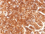 IHC staining of FFPE human adrenal gland tissue with ABCB1 antibody (clone MDR1/8986R). HIER: boil tissue sections in pH 9 10mM Tris with 1mM EDTA for 20 min and allow to cool before testing.
