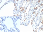 IHC staining of FFPE human lung tissue with EPHB4 antibody (clone EPHB4/6392). Inset: PBS used in place of primary Ab (secondary Ab negative control). HIER: boil tissue sections in pH 9 10mM Tris with 1mM EDTA for 20 min and allow to cool before testing.