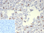IHC staining of FFPE human pancreas tissue with Cystic Fibrosis Transmembrane Regulator antibody (clone rCFTR/8048). Inset: PBS used in place of primary Ab (secondary Ab negative control). HIER: boil tissue sections in pH 9 10mM Tris with 1mM EDTA for 20 min and allow to cool before testing.