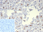 IHC staining of FFPE human pancreas tissue with Cystic Fibrosis Transmembrane Regulator antibody (clone rCFTR/8048). Inset: PBS used in place of primary Ab (secondary Ab negative control). HIER: boil tissue sections in pH 9 10mM Tris with 1mM EDTA for 20 min and allow to cool before testing.