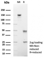 SDS-PAGE analysis of purified, BSA-free CDH17 antibody (clone rCDH17/8512) as confirmation of integrity and purity.