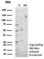 SDS-PAGE analysis of purified, BSA-free LI Cadherin antibody (clone rCDH17/8514) as confirmation of integrity and purity.